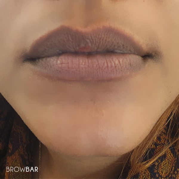 lip discoloration correction in karachi