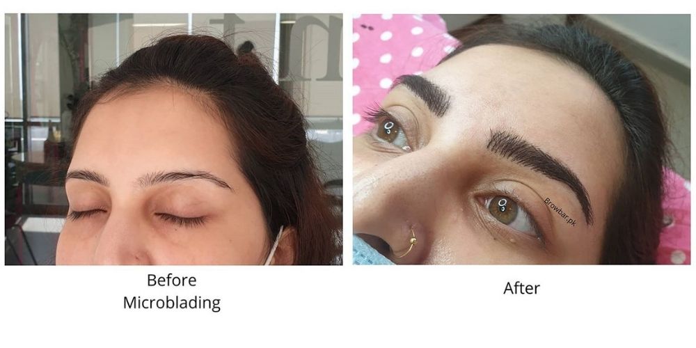 Microblading for Cancer Survivors