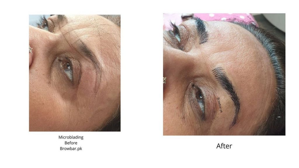 Aftercare of Microblading