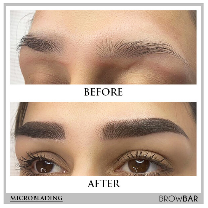 Which Celebrities Have Microblading
