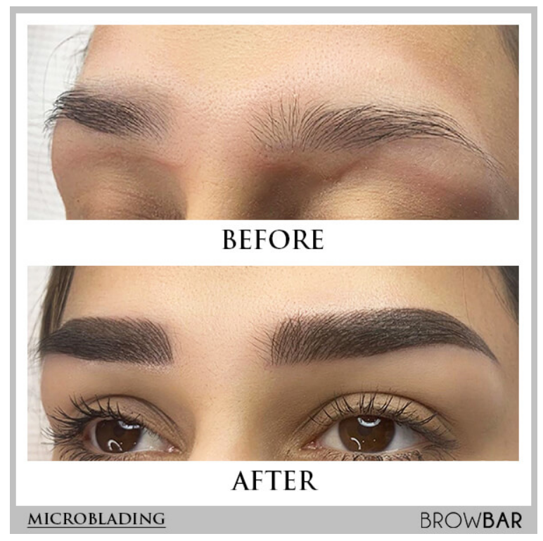 Which Is Better Microblading or Tattooing Eyebrows